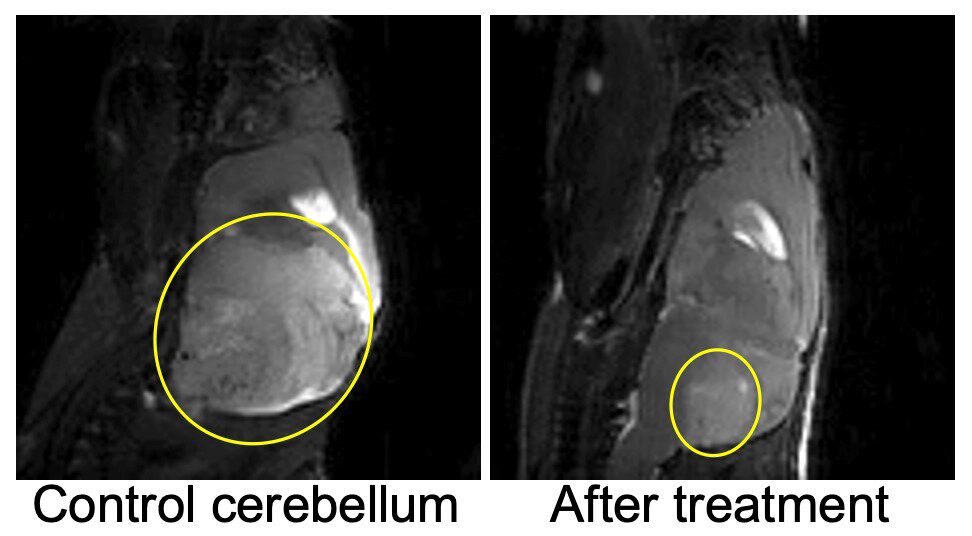 MRI scans of medulloblastoma-bearing mice brain