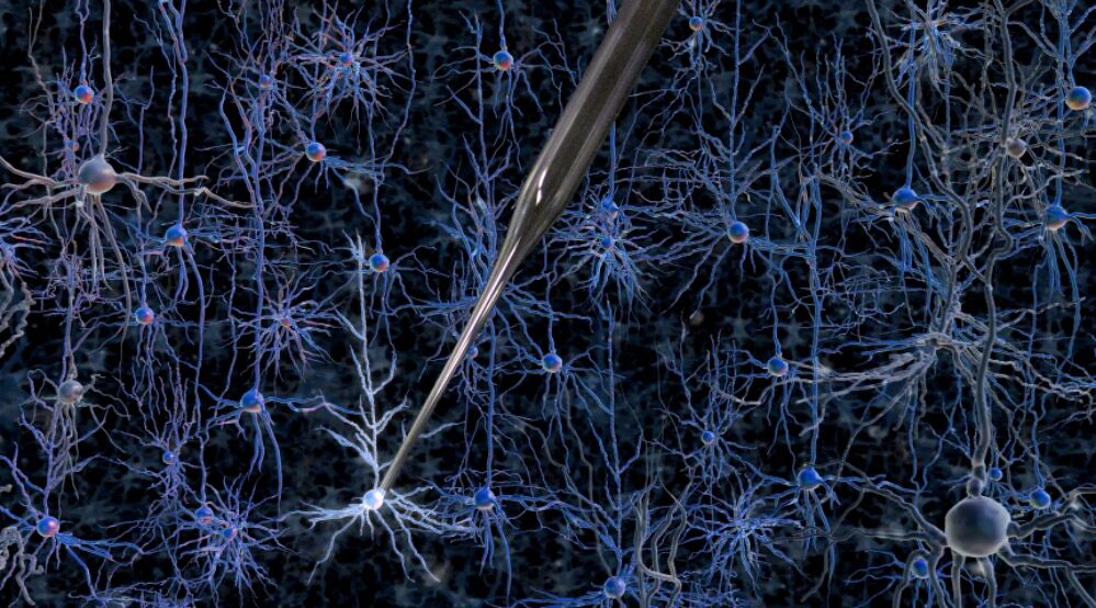 A robotically controlled glass electrode enables single-cell electrical recordings in living brain tissue. Credit: Georgia Tech